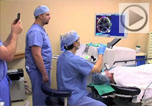 laser cataract