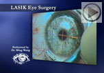 Bladeless all-laser LASIK surgery, Nashville, Tennessee