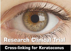 Cross-linking for Keratoconus