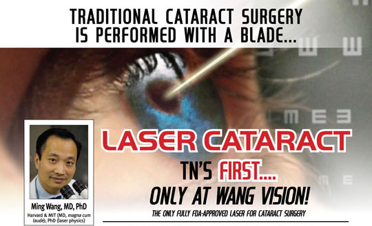 laser cataract