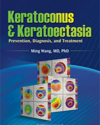 Keratoconus